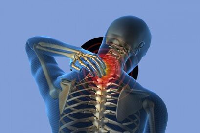 neck pain with osteochondrose