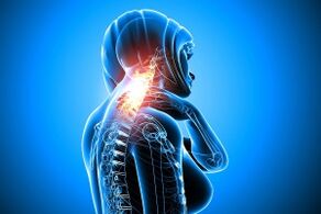 osteochondrosis in the spine of cervix