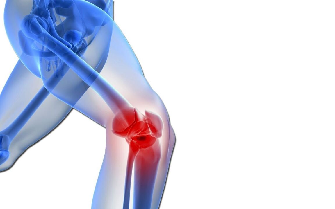 knee pain and its treatment with Artovitel gel